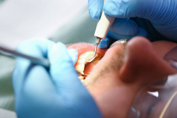 Best Root Canal Emergency Dentist  in Fletcher, OK